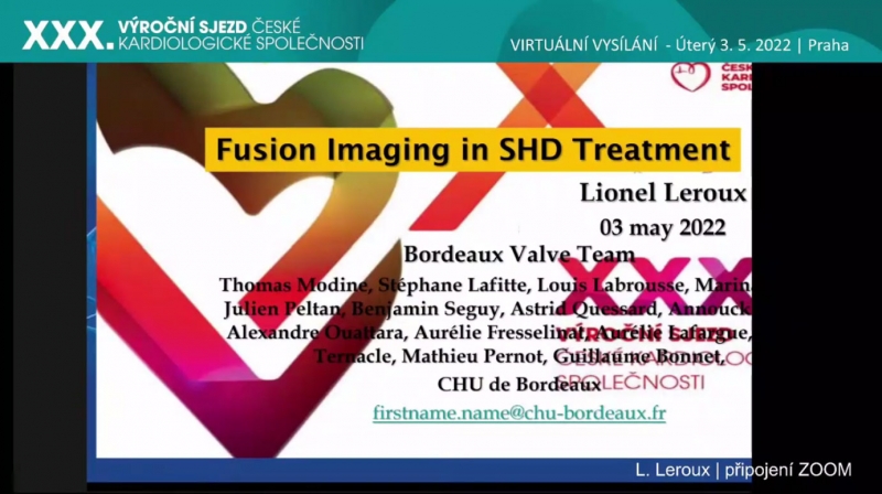 video: FUSION IMAGING IN SHD TREATMENT