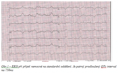 Obr. 1  EKG pi pijet nemocn na standardn oddlen. Je patrn prodlouen interval QTc na 750 ms.