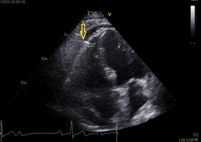 Fig. 4  Transthoracic echocardiogram.