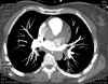CT-AG (42).jpg