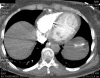 CT-AG (66).jpg