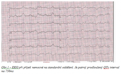 Obr. 1 � EKG p�i p�ijet� nemocn� na standardn� odd�len�. Je patrn� prodlou�en� interval QTc na 750 ms.