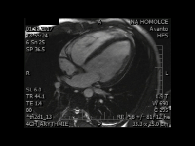file_5cabb059ee42e_94_Video1_MR_upr.mp4.mp4