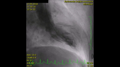 file_5cd0886c7f04a_99_VIDEO4_upr.mp4.mp4