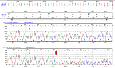 Obr. 6 � V�sledek molekul�rn� genetick� anal�zy: nalezena patogenn� varianta v genu pro plakofilin 2 (PKP2): c.1307_1315delinsATTTAGTT p.(Leu436Hisfs*11). �erven� �ipka ukazuje m�sto mutace. Jedn� se o tzv. frame-shift mutaci, kdy delece nebo inzerce n�kolika nukleotid� zm�n� �tec� r�mec a p�ed�asn� zastav� tvorbu kodonu a proteinovou translaci.
