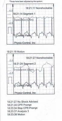 Obr. 2 – Záznam z AED, druhá analýza rytmu, nedefibrilovatelný rytmus